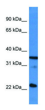 Anti-SFRS2 (C-terminal) antibody produced in rabbit affinity isolated antibody