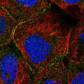 Anti-MTHFSD antibody produced in rabbit Prestige Antibodies® Powered by Atlas Antibodies, affinity isolated antibody, buffered aqueous glycerol solution