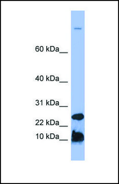 Anti-HAMP, (N-terminal) antibody produced in rabbit affinity isolated antibody