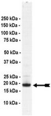 UbcH4 Protein, active, 50 µg Active, full length, recombinant human UbcH4. N-terminal HA, 6His-tagged. For use in Enzyme Assays. Functions as an E2 enzyme in ubiquitination assays.