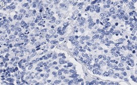 Anti-Stat3 Antibody, clone 2D2 ZooMAb® Rabbit Monoclonal recombinant, expressed in HEK 293 cells