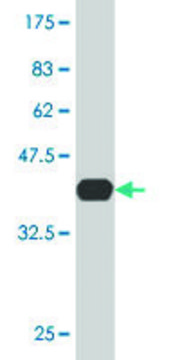 Monoclonal Anti-LIG4, (C-terminal) antibody produced in mouse clone 2D2, purified immunoglobulin, buffered aqueous solution