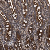 Anti-SPAST antibody produced in rabbit Prestige Antibodies® Powered by Atlas Antibodies, affinity isolated antibody, buffered aqueous glycerol solution