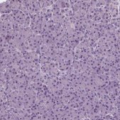 Anti-RASA1 antibody produced in rabbit Prestige Antibodies® Powered by Atlas Antibodies, affinity isolated antibody