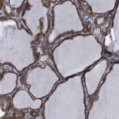 Anti-TCEAL9 antibody produced in rabbit Prestige Antibodies® Powered by Atlas Antibodies, affinity isolated antibody, buffered aqueous glycerol solution