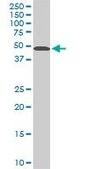 Monoclonal Anti-STK38 antibody produced in mouse clone 2F3, purified immunoglobulin, buffered aqueous solution