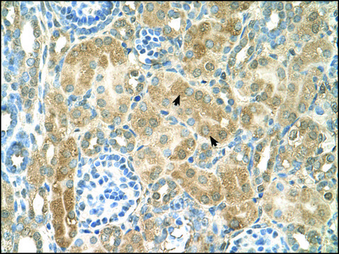 Anti-NR2F2 (AB2) antibody produced in rabbit IgG fraction of antiserum