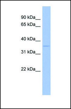 Anti-WNT5B antibody produced in rabbit affinity isolated antibody