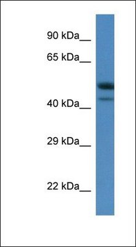 Anti-SBK1 antibody produced in rabbit affinity isolated antibody