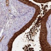 抗-ECM1 兔抗 Prestige Antibodies® Powered by Atlas Antibodies, affinity isolated antibody, buffered aqueous glycerol solution