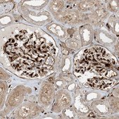 Anti-PPM1F antibody produced in rabbit Prestige Antibodies® Powered by Atlas Antibodies, affinity isolated antibody, buffered aqueous glycerol solution