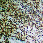 Anti-phospho-HRS (pTyr334) antibody produced in rabbit affinity isolated antibody
