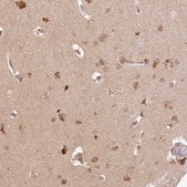 Anti-INPP4B antibody produced in rabbit Prestige Antibodies® Powered by Atlas Antibodies, affinity isolated antibody, buffered aqueous glycerol solution