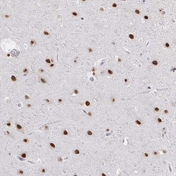 Anti-HNRNPDL antibody produced in rabbit Prestige Antibodies&#174; Powered by Atlas Antibodies, affinity isolated antibody, buffered aqueous glycerol solution