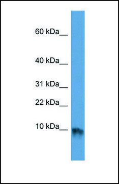 Anti-EGF antibody produced in rabbit affinity isolated antibody