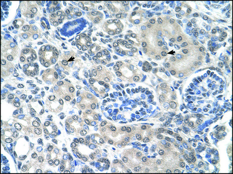 Anti-PPAT antibody produced in rabbit affinity isolated antibody