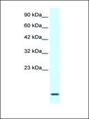 Anti-HOXA1 antibody produced in rabbit IgG fraction of antiserum