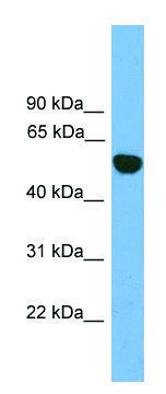 Anti-EPHX1 (N-terminal) antibody produced in rabbit affinity isolated antibody