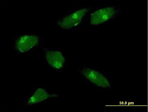 Anti-MGAT1 antibody produced in mouse IgG fraction of antiserum, buffered aqueous solution