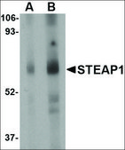 Anti-STEAP1 (ab2) antibody produced in rabbit affinity isolated antibody, buffered aqueous solution