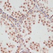 Anti-Phospho-PEA15-S104 antibody produced in rabbit