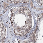Anti-EDC4 antibody produced in rabbit Prestige Antibodies® Powered by Atlas Antibodies, affinity isolated antibody, buffered aqueous glycerol solution