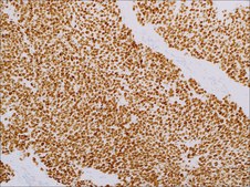 NKX2.2 (EP336) Rabbit Monoclonal Primary Antibody