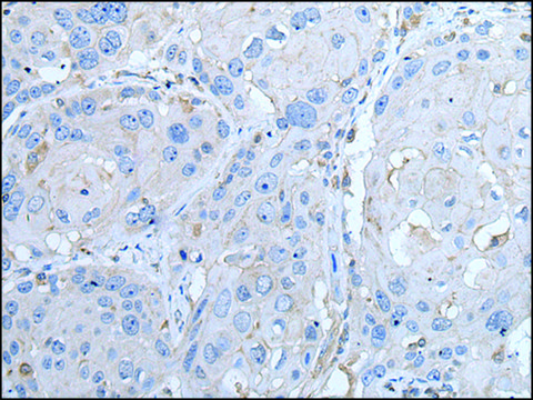 Anti-LTBP4 affinity isolated antibody