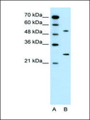 Anti-CACNB1 (AB2) antibody produced in rabbit affinity isolated antibody