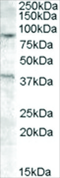 Anti-EXO1 antibody produced in goat affinity isolated antibody, buffered aqueous solution