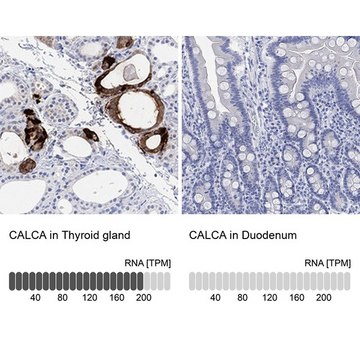 Anti-CALCA antibody produced in rabbit Prestige Antibodies&#174; Powered by Atlas Antibodies, affinity isolated antibody, buffered aqueous glycerol solution