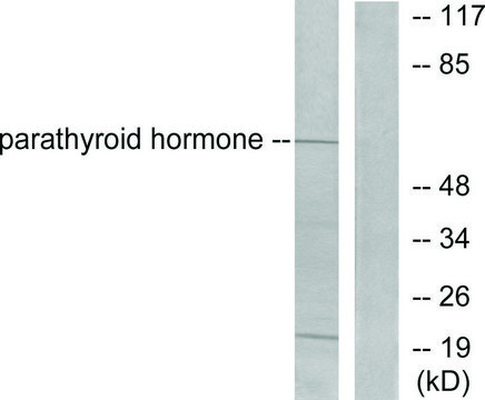 Anti-Parathyroid Hormone antibody produced in rabbit affinity isolated antibody