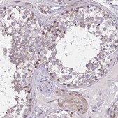 Anti-CHST3 antibody produced in rabbit Prestige Antibodies® Powered by Atlas Antibodies, affinity isolated antibody, buffered aqueous glycerol solution