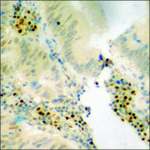 Anti-phospho-p53 (pSer20) antibody produced in rabbit affinity isolated antibody
