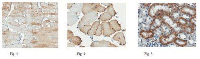 Anti-Monocarboxylate Transporter 1 Antibody from chicken, purified by affinity chromatography