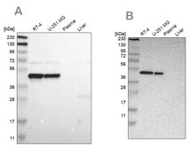 Anti-FAM98B antibody produced in rabbit Prestige Antibodies® Powered by Atlas Antibodies, affinity isolated antibody, buffered aqueous glycerol solution