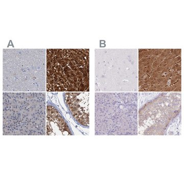 Anti-FAH antibody produced in rabbit Prestige Antibodies&#174; Powered by Atlas Antibodies, affinity isolated antibody, buffered aqueous glycerol solution