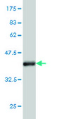 Monoclonal Anti-EPSTI1 antibody produced in mouse clone 2A8, purified immunoglobulin, buffered aqueous solution