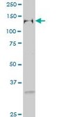 Monoclonal Anti-GTF2I, (C-terminal) antibody produced in mouse clone 2D6, purified immunoglobulin, buffered aqueous solution
