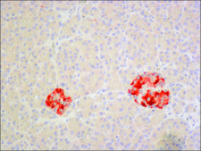 Anti-IAPP antibody produced in rabbit ~1.0 mg/mL, affinity isolated antibody