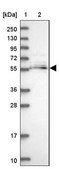 Anti-MGAT2 antibody produced in rabbit Prestige Antibodies® Powered by Atlas Antibodies, affinity isolated antibody, buffered aqueous glycerol solution