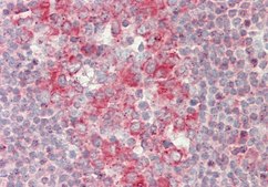 Anti-RAPGEF1 antibody produced in rabbit affinity isolated antibody