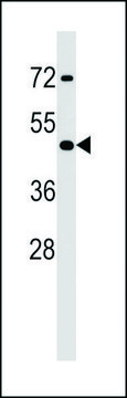 ANTI-MOUSE HOXA2 (CENTER) antibody produced in rabbit IgG fraction of antiserum, buffered aqueous solution