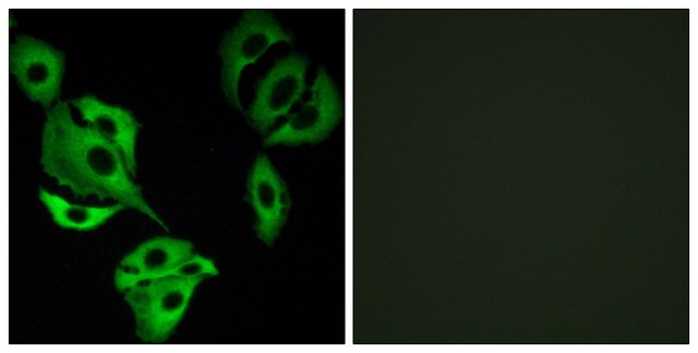 Anti-ADCK4 antibody produced in rabbit affinity isolated antibody