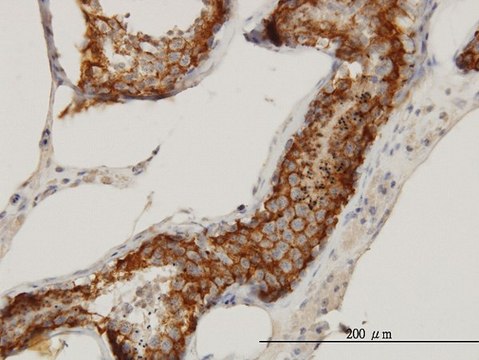 Monoclonal Anti-FATE1 antibody produced in mouse clone 3B1, purified immunoglobulin, buffered aqueous solution