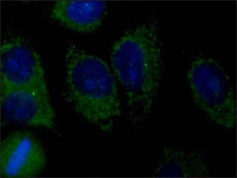 Anti-AMSH-LP/STAMBPL1 antibody produced in rabbit ~1.0&#160;mg/mL, affinity isolated antibody