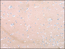 Anti-ZNF106 affinity isolated antibody