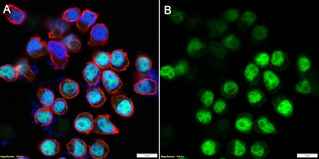 Anti-IRF-4 Antibody, clone 1E10 ZooMAb&#174; Rabbit Monoclonal recombinant, expressed in HEK 293 cells