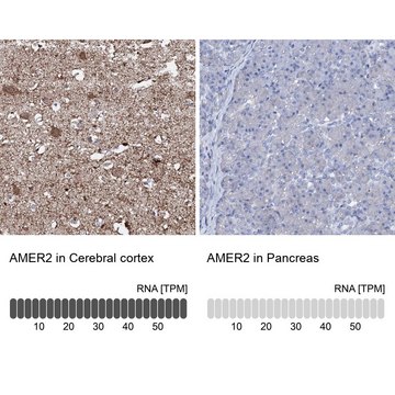 Anti-AMER2 antibody produced in rabbit Prestige Antibodies&#174; Powered by Atlas Antibodies, affinity isolated antibody, buffered aqueous glycerol solution