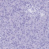 抗-PATE4 兔抗 Prestige Antibodies® Powered by Atlas Antibodies, affinity isolated antibody, buffered aqueous glycerol solution